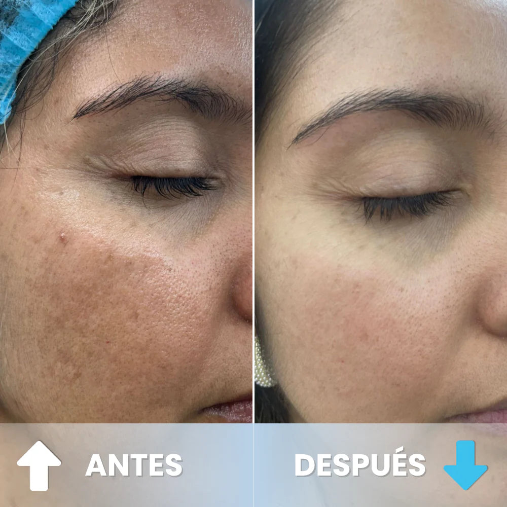 DragoSkin™ Crema Hidratante Antienvejecimiento Con Retinol y Sangre de Dragón