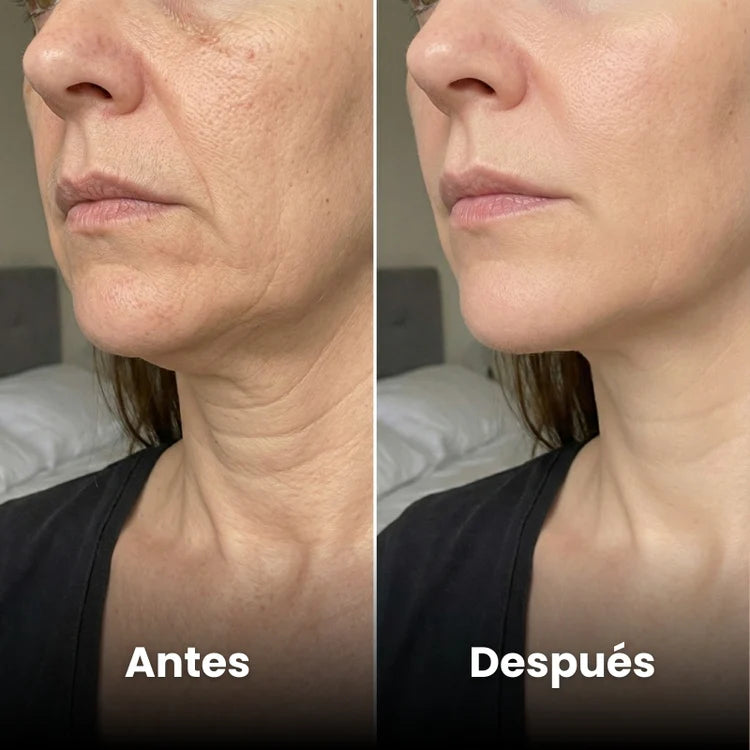 Ana L. / 43 Años